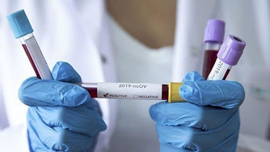 Three new coronavirus patients detected in Bangladesh