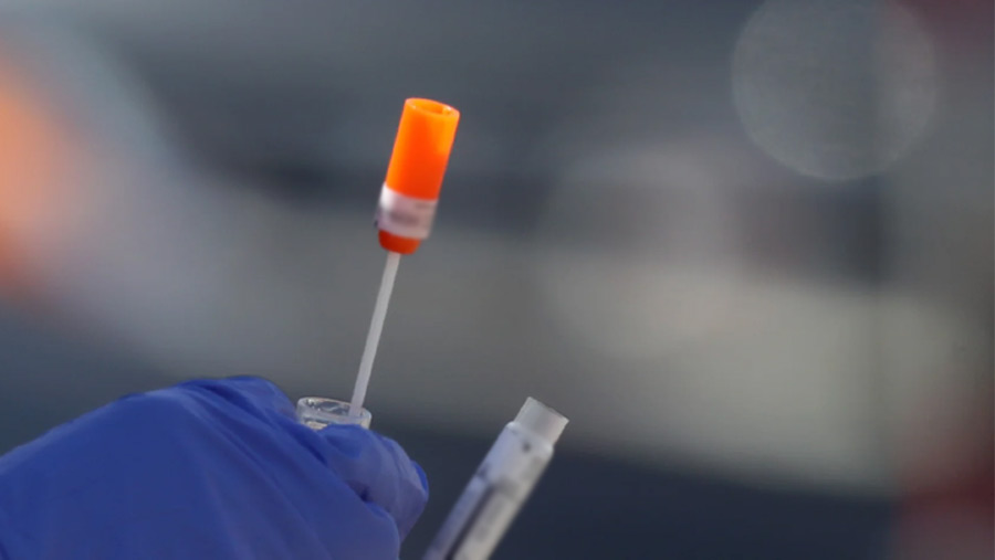 What WHO said on NeoCov, discovered by scientists