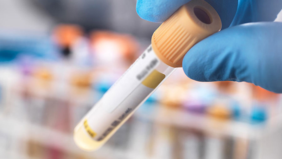 Turkish passenger with rashes not a Monkeypox case