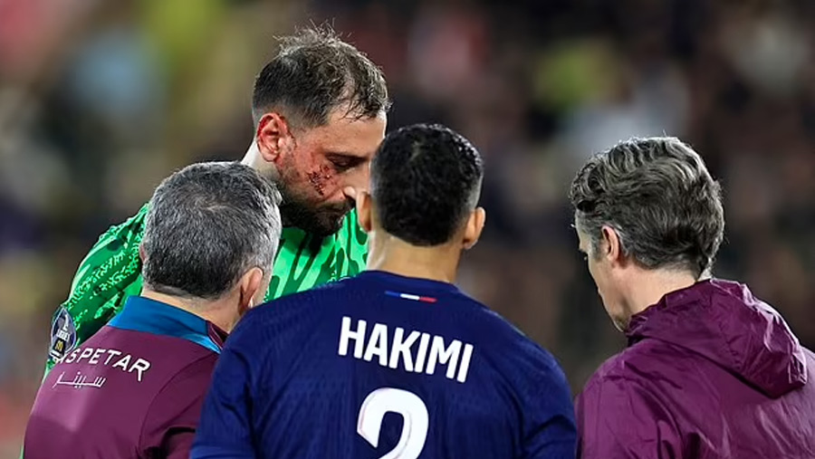 Donnarumma suffers facial injury in PSG win